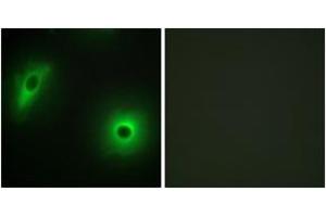 Immunofluorescence analysis of HeLa cells, using 14-3-3 eta Antibody.
