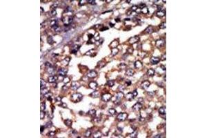 Image no. 2 for anti-Protein Kinase, CAMP-Dependent, Regulatory, Type I, alpha (Tissue Specific Extinguisher 1) (PRKAR1A) (N-Term) antibody (ABIN360569)