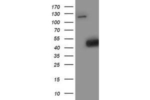 Western Blotting (WB) image for anti-Spermine Synthase, SMS (SMS) antibody (ABIN1501099) (SMS anticorps)
