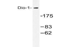 Western blot (WB) analysis with extracts from 293 cells using DIDO1 /  Dio-1 antibody . (DIDO1 anticorps)