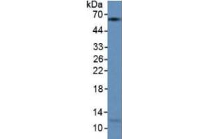 Rabbit Detection antibody from the kit in WB with Positive Control: Human lung lysate. (KRT9 Kit ELISA)