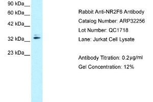 Western Blotting (WB) image for anti-Nuclear Receptor Subfamily 2, Group F, Member 6 (NR2F6) (N-Term) antibody (ABIN2779525)