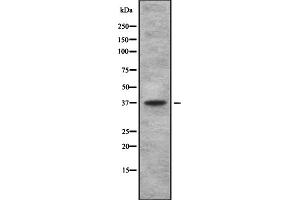 Western blot analysis of TAS2R using 293 whole cell lysates (TBXA2R anticorps  (C-Term))