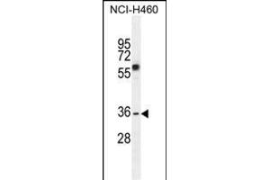 C10orf72 Antibody (Center) (ABIN655143 and ABIN2844765) western blot analysis in NCI- cell line lysates (35 μg/lane). (VSTM4 anticorps  (AA 142-170))