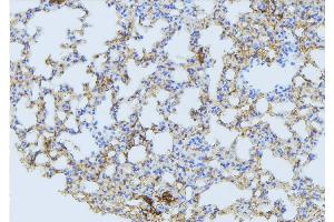 ABIN6275088 at 1/100 staining Mouse lung tissue by IHC-P. (MARCH3 anticorps  (Internal Region))