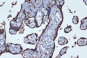 Immunohistochemistry of paraffin-embedded human placenta using PGE Receptor EP2 (PGE Receptor EP2 (PGE receptor EP2 (PTGER2))) Rabbit mAb (ABIN7269572) at dilution of 1:100 (40x lens).
