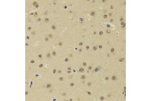 Immunohistochemistry of paraffin-embedded Rat brain using DNTT antibody at dilution of 1:100 (x400 lens). (TdT anticorps)
