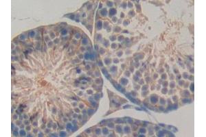 DAB staining on IHC-P; Samples: Mouse Testis Tissue (LBP anticorps  (AA 25-481))