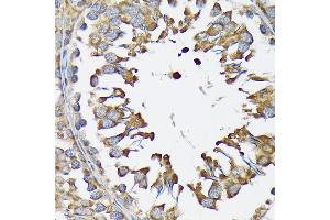 Immunohistochemistry of paraffin-embedded rat testis using LysRS/KARS Rabbit mAb (ABIN7268350) at dilution of 1:100 (40x lens). (KARS anticorps)