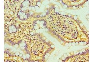 Immunohistochemistry of paraffin-embedded human small intestine tissue using ABIN7162382 at dilution of 1:100 (HIV-1 Tat Interactive Protein 2, 30kDa (HTATIP2) (AA 1-230) anticorps)