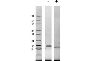 SDS-PAGE of Rat Macrophage Inflammatory Protein-1 alpha (CCL3) Recombinant Protein SDS-PAGE of Rat Macrophage Inflammatory Protein-1 alpha (CCL3) Recombinant Protein. (CCL3 Protéine)