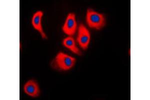 Immunofluorescent analysis of JIP2 staining in Raw264. (IB2 anticorps  (C-Term))