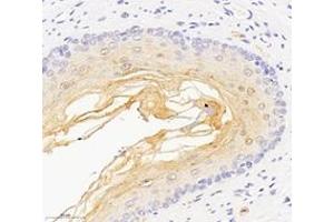 Immunohistochemistry analysis of paraffin-embedded rat esophagus using,DSP (ABIN7073719) at dilution of 1: 1000