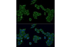 Immunofluorescence analysis of HeLa cells using IRF3 antibody (ABIN6128099, ABIN6142528, ABIN6142531 and ABIN7101371) at dilution of 1:100 (40x lens). (IRF3 anticorps  (AA 1-260))