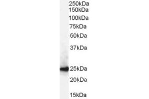 Image no. 1 for anti-Chromobox Homolog 1 (CBX1) (Internal Region) antibody (ABIN374618) (CBX1 anticorps  (Internal Region))