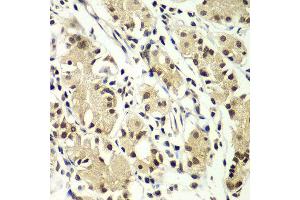 Immunohistochemistry of paraffin-embedded human gastric using ZNF264 antibody at dilution of 1:100 (x400 lens). (ZNF264 anticorps)