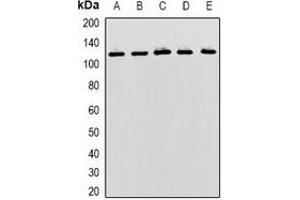 Western blot analysis of MBTPS1 expression in Hela (A), SKOV3 (B), mouse liver (C), mouse kidney (D), rat brain (E) whole cell lysates.