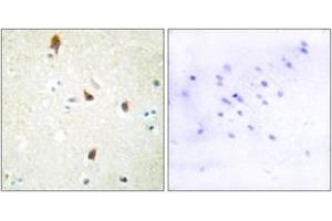 Immunohistochemistry (IHC) image for anti-Serotonin Receptor 2B (HTR2B) (AA 261-310) antibody (ABIN2889845)