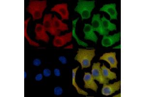 TGF beta Receptor III Mouse Monoclonal Antibody staining HepG2 cells by IF/ICC.