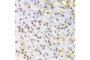 Immunohistochemistry of paraffin-embedded rat kidney using SFN Antibody. (14-3-3 sigma/SFN anticorps  (AA 1-248))