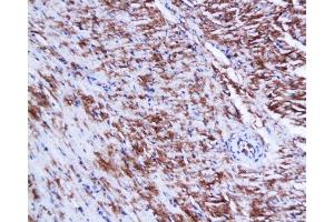 Formalin-fixed and paraffin embedded mouse heart tissue labeled Anti-Connexin-45 Polyclonal Antibody, Unconjugated  at 1:200, followed by conjugation to the secondary antibody and DAB staining