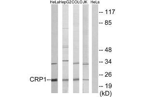 Western Blotting (WB) image for anti-Cysteine and Glycine-Rich Protein 1 (CSRP1) (Internal Region) antibody (ABIN1849240) (CSRP1 anticorps  (Internal Region))