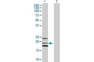 Western Blot analysis of PTGDS expression in transfected 293T cell line by PTGDS MaxPab polyclonal antibody. (PTGDS anticorps  (AA 1-190))
