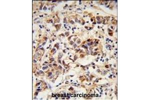 anti-Small Proline Rich Protein 1B (SPRR1B) (AA 63-89), (C-Term) antibody
