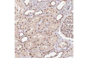 Immunohistochemical staining (Formalin-fixed paraffin-embedded sections) of human kidney with CAND1 polyclonal antibody  shows moderate cytoplasmic and nuclear positivity in renal tubules at 1:1000 - 1:2500 dilution. (CAND1 anticorps)