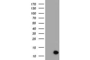 Image no. 1 for anti-Chromosome 17 Open Reading Frame 37 (C17orf37) antibody (ABIN1501775) (C17orf37 anticorps)