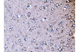 IHC analysis of PAK3 using anti-PAK3 antibody (ABIN7599182).