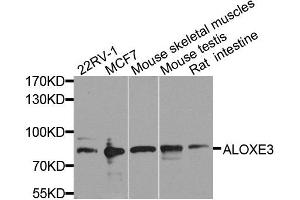 anti-Arachidonate Lipoxygenase 3 (ALOXE3) (AA 1-280) antibody