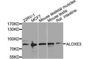 Western blot analysis of extracts of various cell lines, using ALOXE3 antibody. (ALOXE3 anticorps  (AA 1-280))
