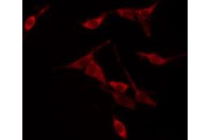 ABIN6267566 staining NIH-3T3 by IF/ICC. (14-3-3 zeta anticorps  (pThr232))