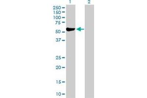 Western Blot analysis of ALDH3A1 expression in transfected 293T cell line by ALDH3A1 MaxPab polyclonal antibody. (ALDH3A1 anticorps  (AA 1-453))