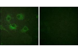 Immunofluorescence analysis of HuvEc cells, using Claudin 3 antibody. (Claudin 3 anticorps)