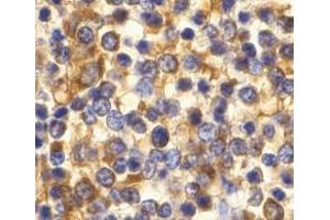 Immunohistochemistry of CCR3 in human spleen tissue with CCR3 antibody at 10 μg/ml.
