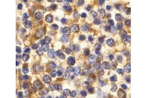 Immunohistochemistry of CCR3 in human spleen tissue with CCR3 antibody at 10 μg/ml. (CCR3 anticorps  (C-Term))