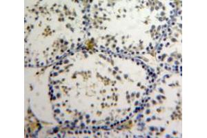 Used in DAB staining on fromalin fixed paraffin-embedded Testis tissue
