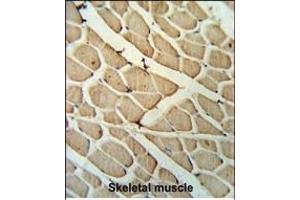 YTHD3 Antibody (Center) ABIN653943 IHC analysis in formalin fixed and paraffin embedded skeletal muscle followed by peroxidase conjugation of the secondary antibody and DAB staining.