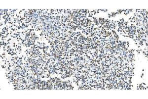 IHC analysis of DRP1/DNM1L using anti-DRP1/DNM1L antibody (ABIN7602180). (Dynamin 1-Like anticorps  (AA 618-736))