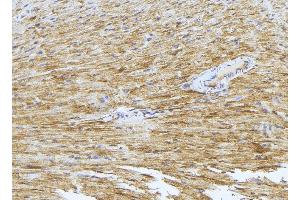 ABIN6277410 at 1/100 staining Mouse muscle tissue by IHC-P.