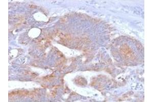 Formalin-fixed, paraffin-embedded human Colon stained with CD86 Mouse Recombinant Monoclonal Antibody (rC86/1146).