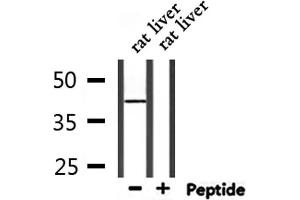 Western blot analysis of extracts from rat liver, using CDK9 Antibody.