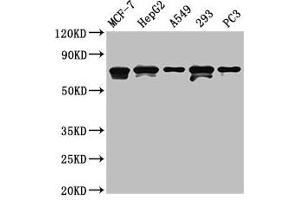 Western Blot Positive WB detected in: MCF-7 whole cell lysate, HepG2 whole cell lysate, A549 whole cell lysate, 293 whole cell lysate, PC-3 whole cell lysate All lanes: MAGED2 antibody at 4. (MAGED2 anticorps  (AA 38-285))