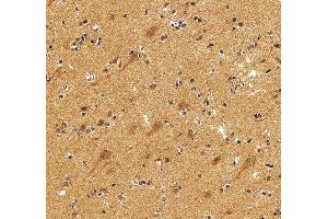 IHC analysis of NEDD4 using anti-NEDD4 antibody (ABIN7599536).