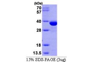 SDS-PAGE (SDS) image for Sulfotransferase Family 1E Member 1 (SULT1E1) (AA 1-294) protein (His tag) (ABIN666751)