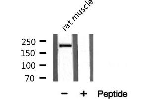 Western blot analysis on rat muscle tissue lysate using Sodium Channel-pan Antibody (Sodium Channel-Pan anticorps)