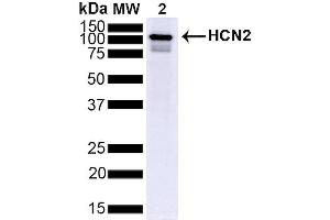 Western Blot analysis of Mouse Brain showing detection of ~95 kDa HCN2 protein using Mouse Anti-HCN2 Monoclonal Antibody, Clone S71 (ABIN361764). (HCN2 anticorps  (AA 761-863))
