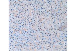 IHC-P analysis of Human Liver Tissue, with DAB staining. (PANX1 anticorps  (AA 228-411))